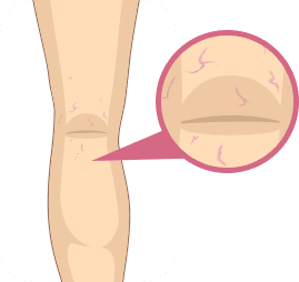 Etapa 1