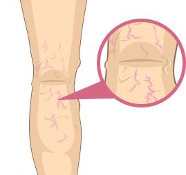 Etapa 2